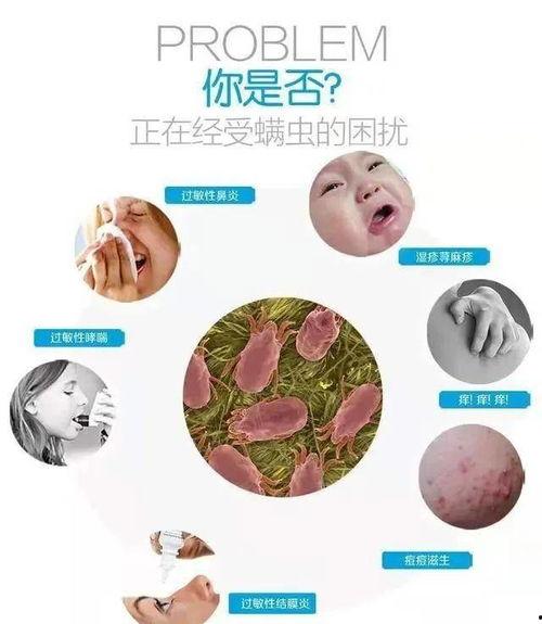 成人过敏如何脱敏治疗视频,视频教程详解