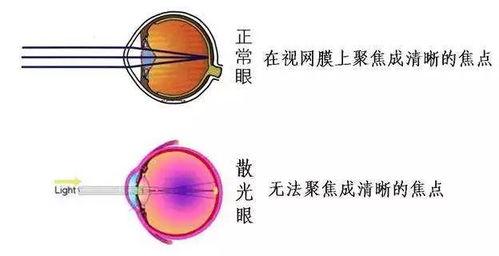 成人散光近视训练视频,成人散光近视训练视频深度解析