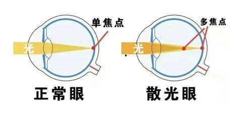 成人散光近视训练视频,成人散光近视训练视频深度解析