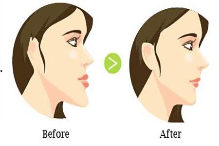 成人侧颈矫正视频,轻松解锁优雅颈部线条