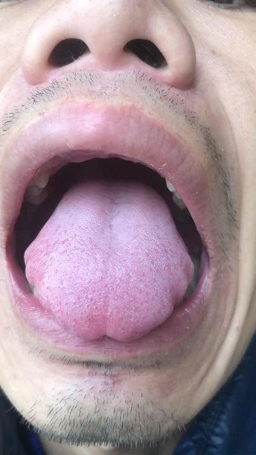 成人洗舌苔视频大全,视频大全全解析